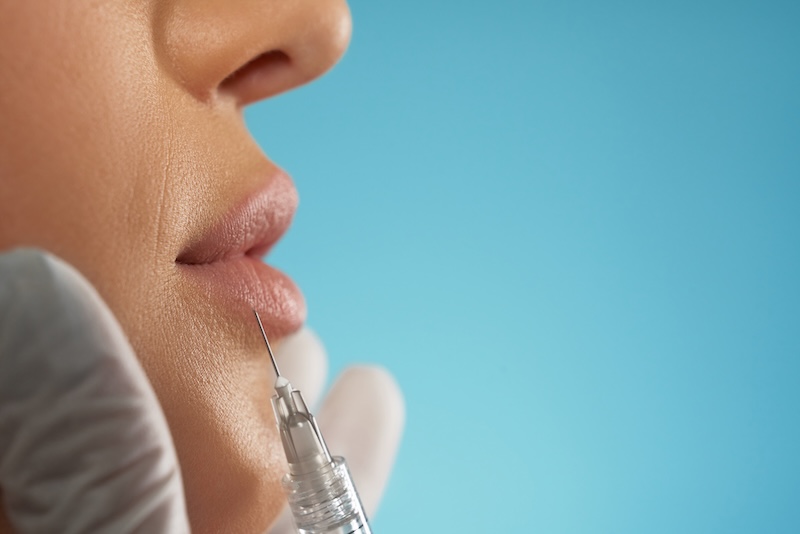 Botox injection